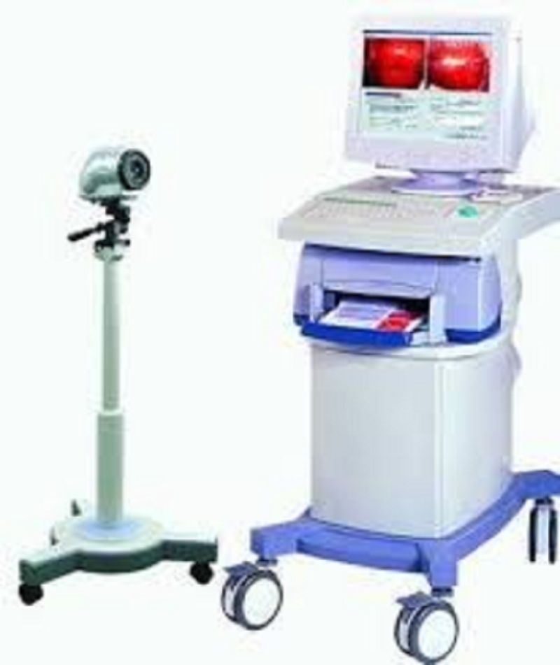 MM-5 digitalni kolposkop,2 cena Beograd